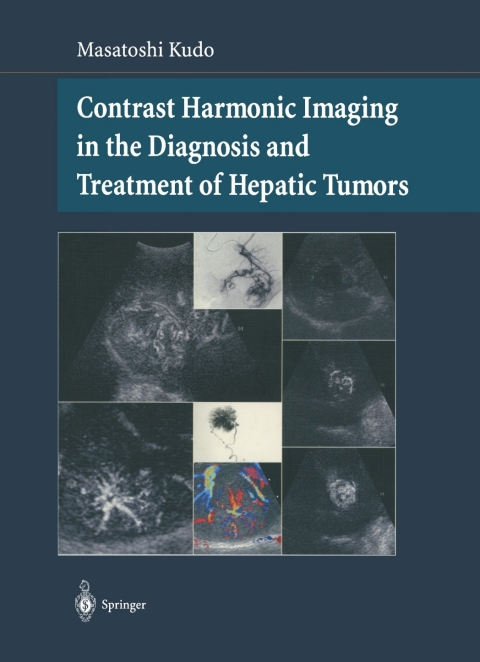 Cover image for book Contrast Harmonic Imaging in the Diagnosis and Treatment of Hepatic Tumors