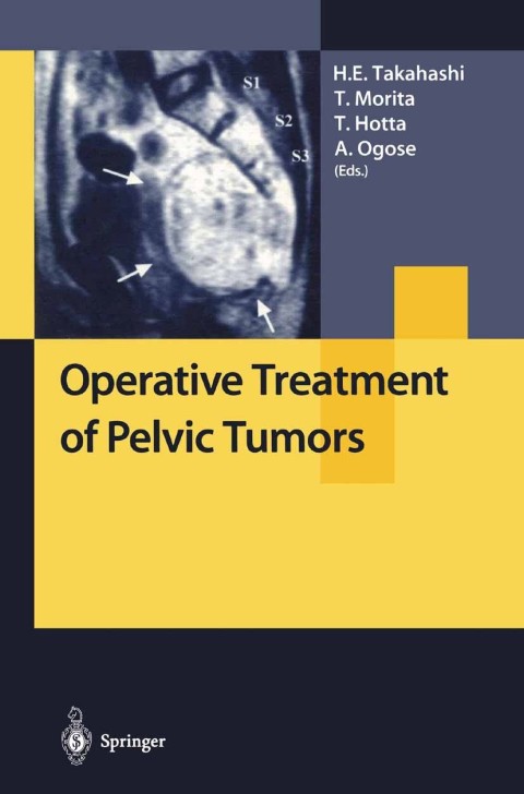 Cover image for book Operative Treatment of Pelvic Tumors