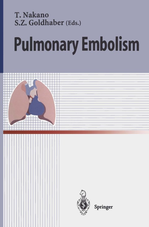 Cover image for book Pulmonary Embolism