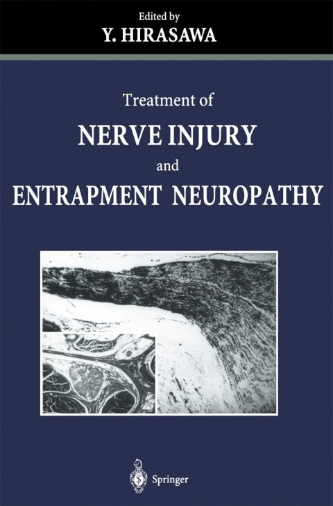 Cover image for book Treatment of Nerve Injury and Entrapment Neuropathy