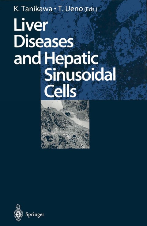 Cover image for book Liver Diseases and Hepatic Sinusoidal Cells