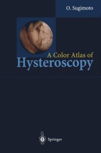 Cover image: A Color Atlas of Hysteroscopy 9784431702443