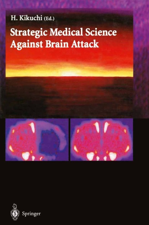 Cover image for book Strategic Medical Science Against Brain Attack