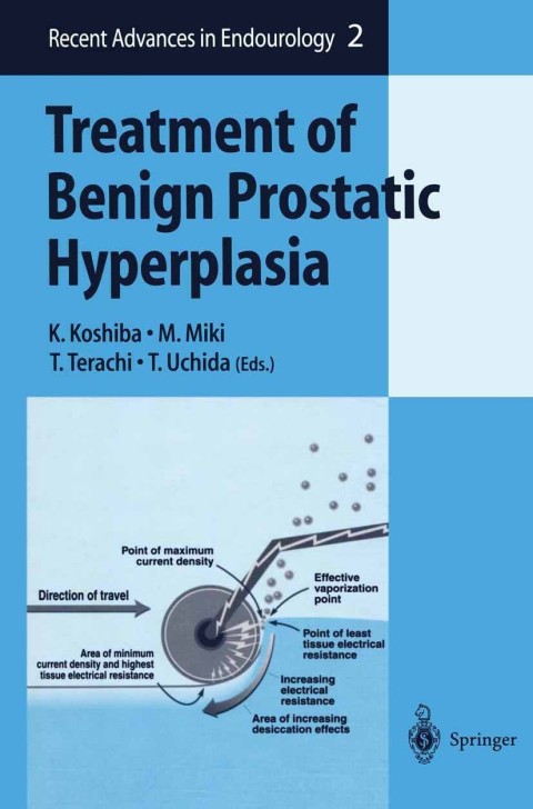 Cover image for book Treatment of Benign Prostatic Hyperplasia