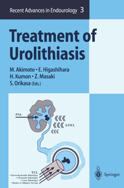 Cover image for book Treatment of Urolithiasis