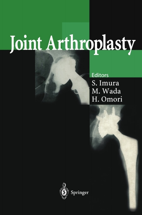 Cover image for book Joint Arthroplasty