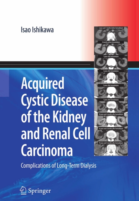 Cover image for book Acquired Cystic Disease of the Kidney and Renal Cell Carcinoma