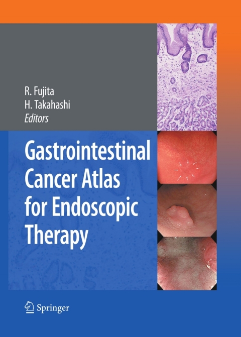 Cover image for book Gastrointestinal Cancer Atlas for Endoscopic Therapy