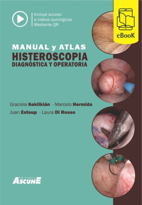 Cover image for book Manual y Atlas de histeroscopia diagnóstica y operatoria