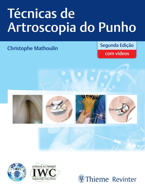 Cover image for book Técnicas de Artroscopia do Punho