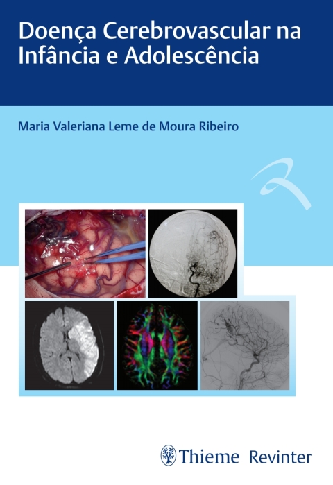 Cover image for book Doença Cerebrovascular na Infância e Adolescência