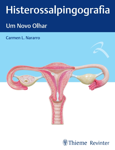 Cover image for book Histerossalpingografia: Um Novo Olhar