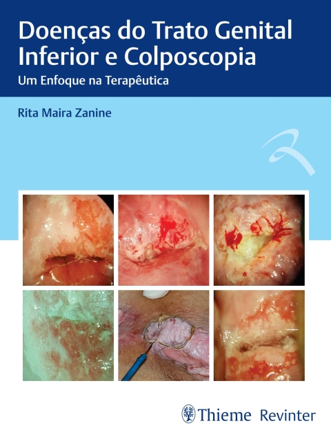 Cover image for book Doenças do Trato Genital Inferior e Colposcopia: Um Enfoque na Terapêutica