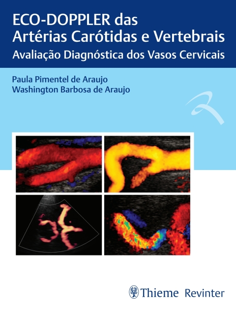 Cover image for book ECO-DOPPLER das Artérias Carótidas e Vertebrais: Avaliação Diagnóstica dos Vasos Cervicais