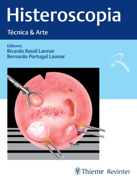 Cover image for book Histeroscopia: Técnica & Arte