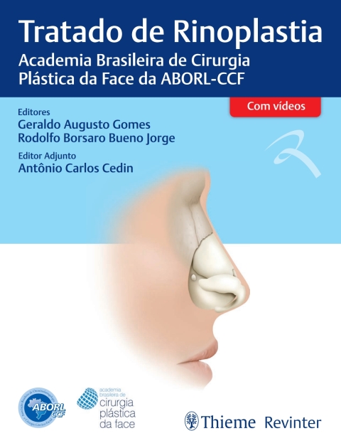 Cover image for book Tratado de Rinoplastia: Academia Brasileira de Cirurgia Plástica da Face da ABORL-CCF