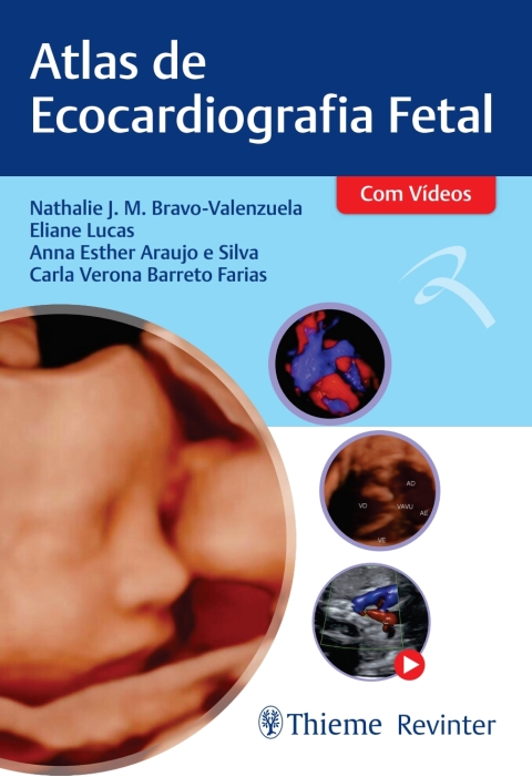 Cover image for book Atlas de Ecocardiografia Fetal