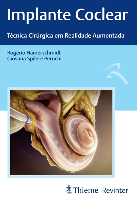 Cover image for book Implante Coclear: Técnicas Cirúrgica em Realidade Aumentada