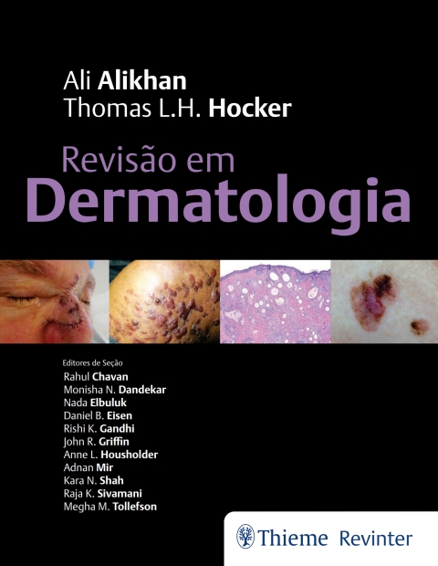 Cover image for book Revisão em Dermatologia