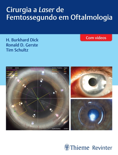 Cover image for book Cirurgia a Laser de Femtossegundo em Oftalmologia