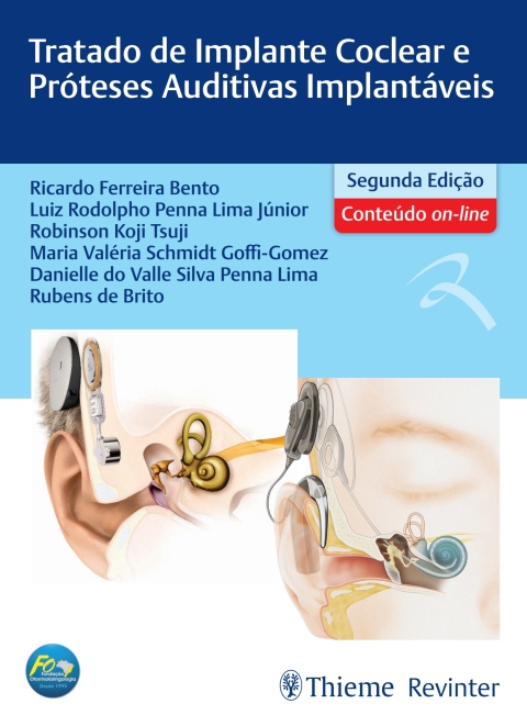Cover image for book Tratado de Implante Coclear e Próteses Auditivas Implantáveis