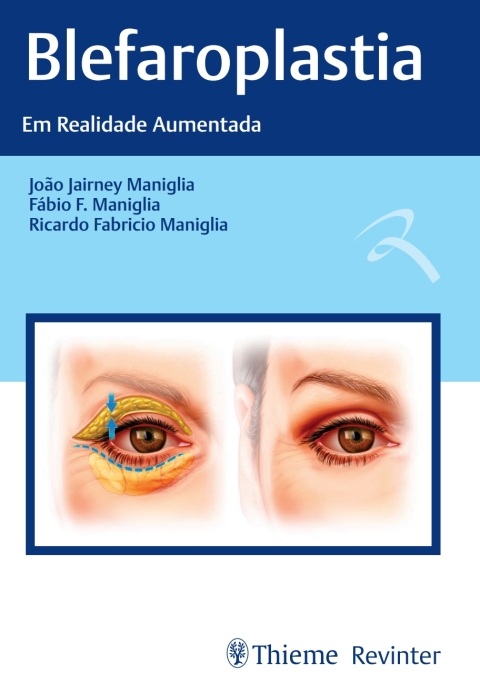 Cover image for book Blefaroplastia: Em Realidade Aumentada