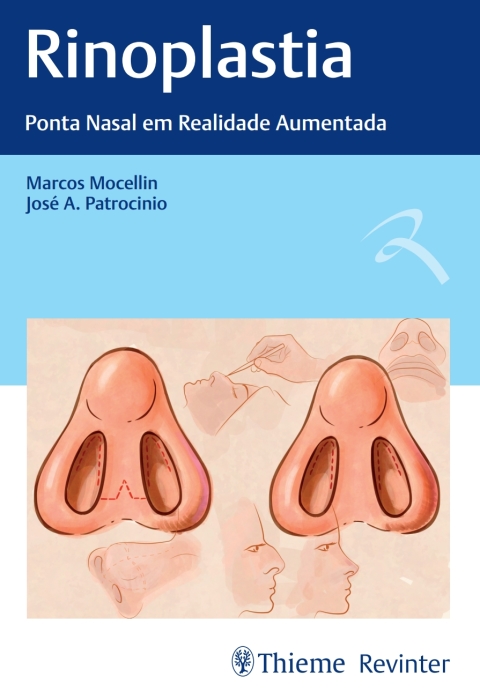 Cover image for book Rinoplastia: Ponta Nasal em Realidade Aumentada