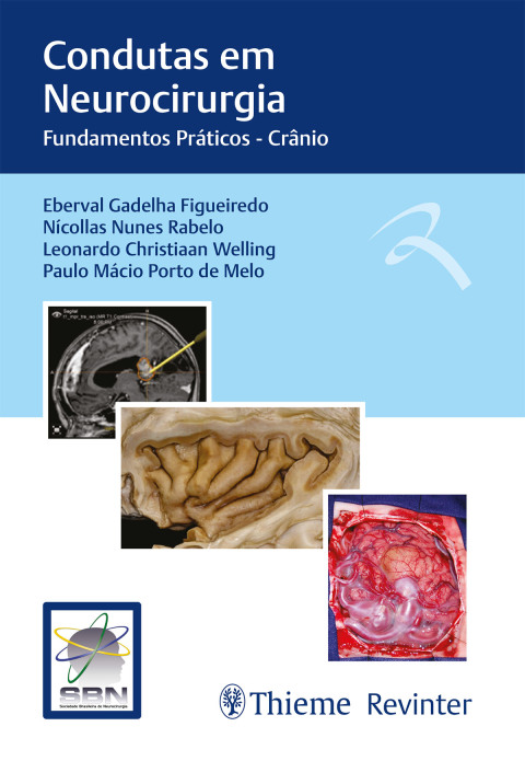 Cover image for book Condutas em Neurocirurgia: Fundamentos Práticos - Crânio