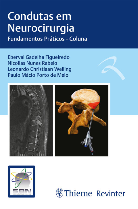 Cover image for book Condutas em Neurocirurgia: Fundamentos Práticos - Coluna