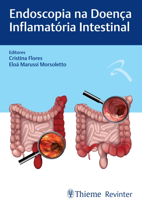 Cover image for book Endoscopia na Doença Inflamatória Intestinal