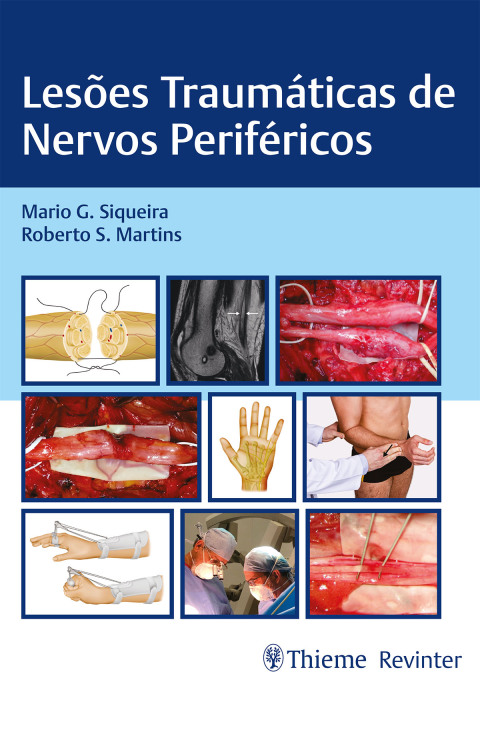 Cover image for book Lesões Traumáticas de Nervos Periféricos