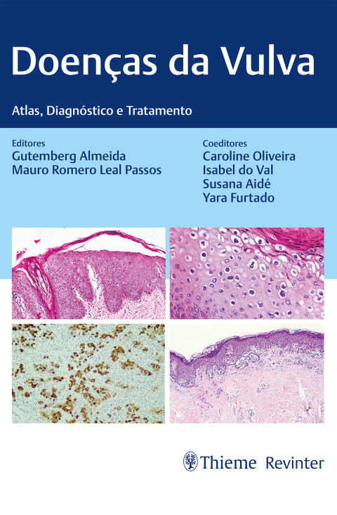 Cover image for book Doenças da Vulva: Atlas, Diagnóstico e Tratamento