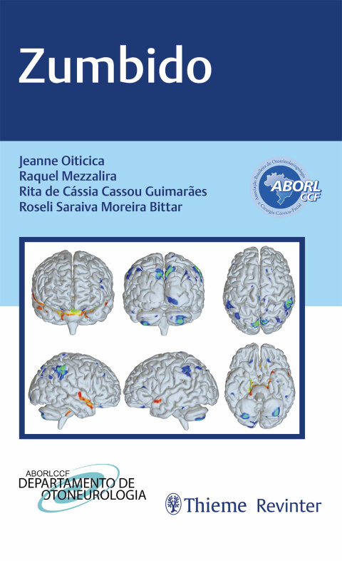 Cover image for book Zumbido