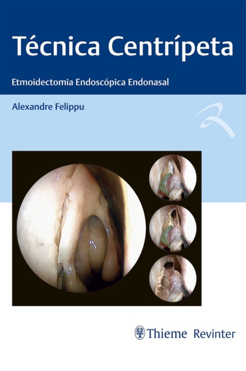 Cover image for book Técnica Centrípeta: Etmoidectomia Endoscópica Endonasal
