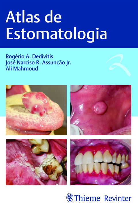 Cover image for book Atlas de Estomatologia