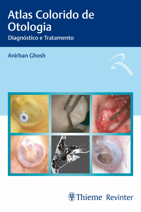 Cover image for book Atlas Colorido de Otologia: Diagnóstico e Tratamento