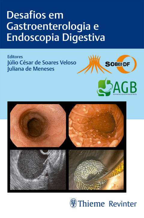 Cover image for book Desafios em Gastroenterologia e Endoscopia Digestiva