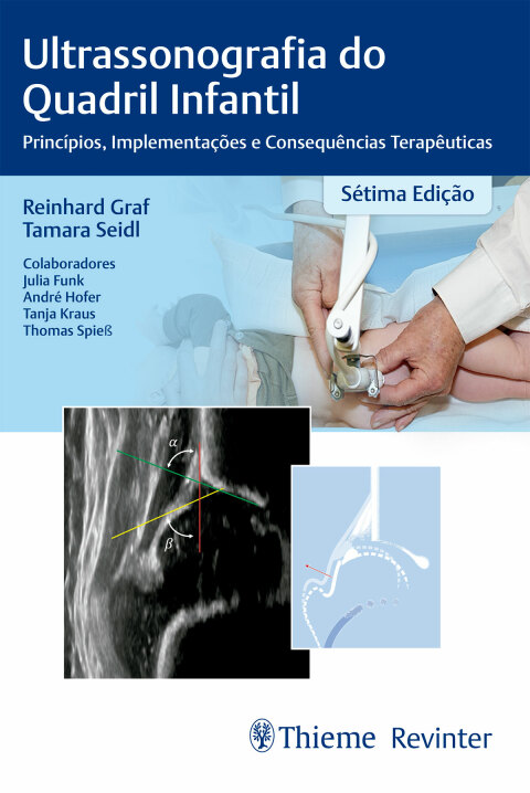 Cover image for book Ultrassonografia do quadril infantil: princípios, implementação e consequências terapêuticas
