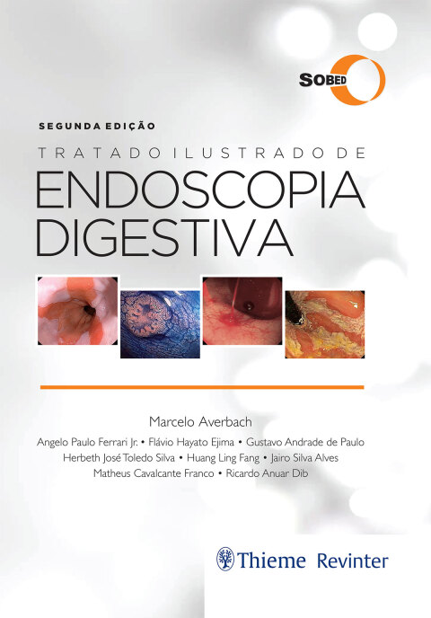 Cover image for book Tratado Ilustrado de Endoscopia Digestiva