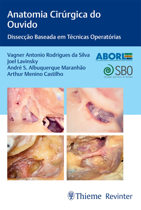 Cover image for book Anatomia Cirúrgica do Ouvido: Dissecção Baseada em Técnicas Operatórias