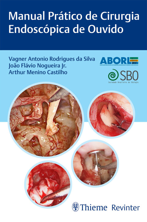 Cover image for book Manual Prático de Cirurgia Endoscópica de Ouvido