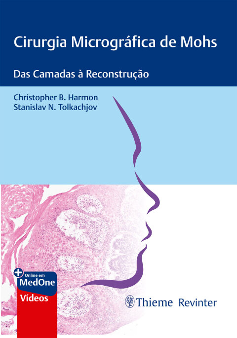 Cover image for book Cirurgia Micrográfica de Mohs: Das Camadas à Reconstrução