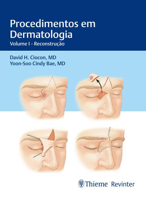 Cover image for book Procedimentos em Dermatologia: Reconstrução. v.I
