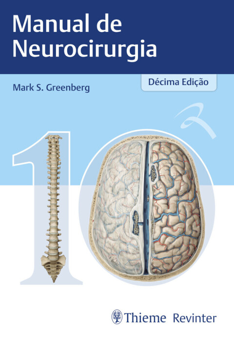 Cover image for book Manual de Neurocirurgia