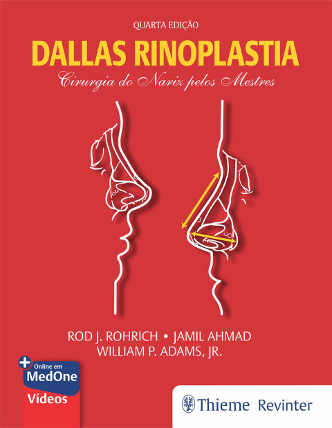 Cover image for book Dallas Rinoplastia : Cirurgia do Nariz pelos Mestres