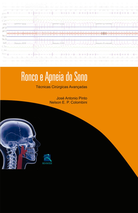 Cover image for book Ronco e Apneia do Sono : Técnicas Cirúrgicas Avançadas
