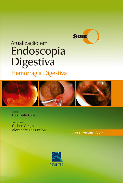 Cover image for book SOBED Atualização em Endoscopia Digestiva - Volume 1 : Hemorragia Digestiva