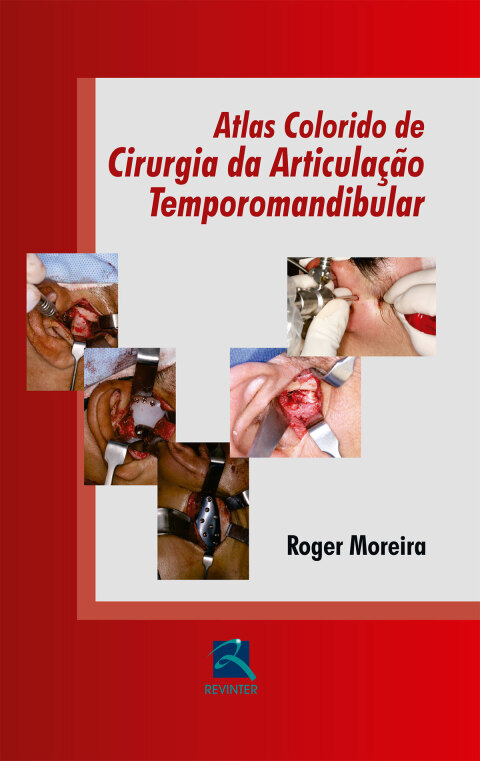Cover image for book Atlas Colorido de Cirurgia da ATM