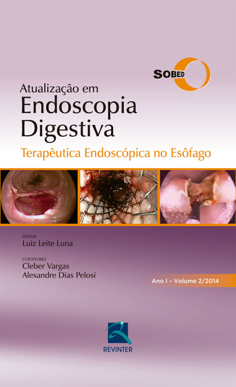 Cover image for book SOBED Atualização em Endoscopia Digestiva - Volume 2  : Terapêutica Endoscópica no Esôfago - Ano 1