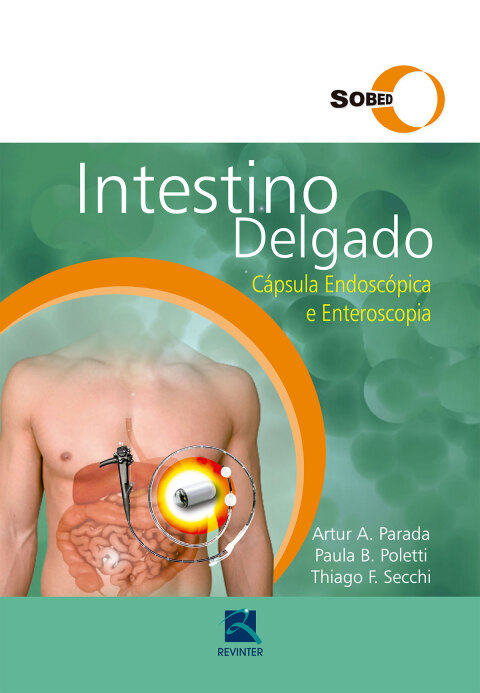 Cover image for book SOBED Intestino delgado : Cápsula Endoscópica e Enteroscopia